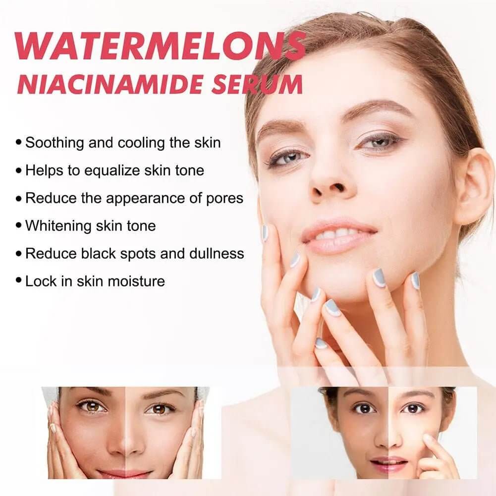 Watermelon Glow Niacinamide Moisturize Serum,Moisturizing Facial Serum W/ Hyaluronic Acid Vitamin E,Hydrating Brighten Skincare - The Skin Essence